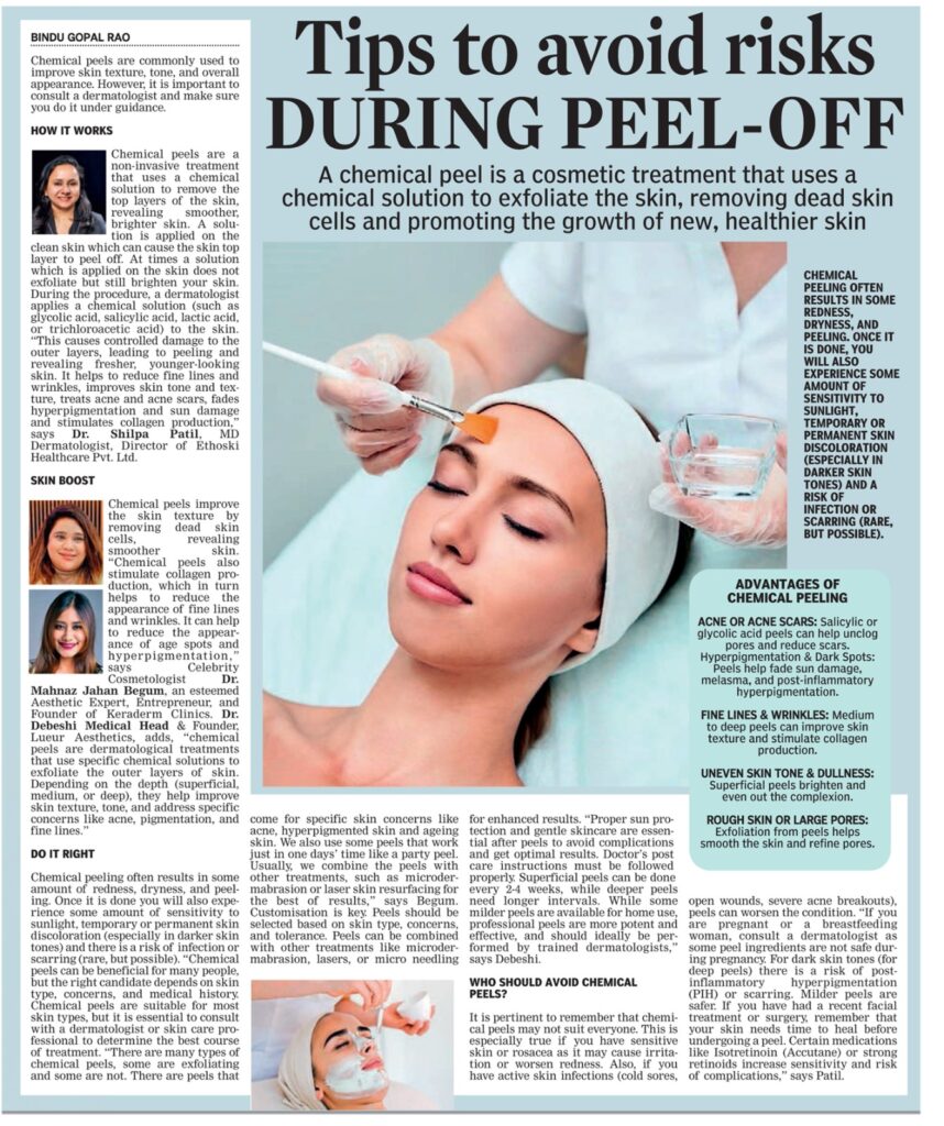 Chemical Peels